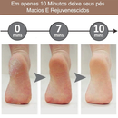 Removedor de Rachaduras e Calos nos Pés - PinkPerfect